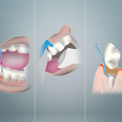Illustration Titel ZAAK 1